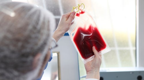 A new study found that stress on ultramarathoners' bodies weakens the intestinal wall and allows endotoxins to leak into the bloodstream.