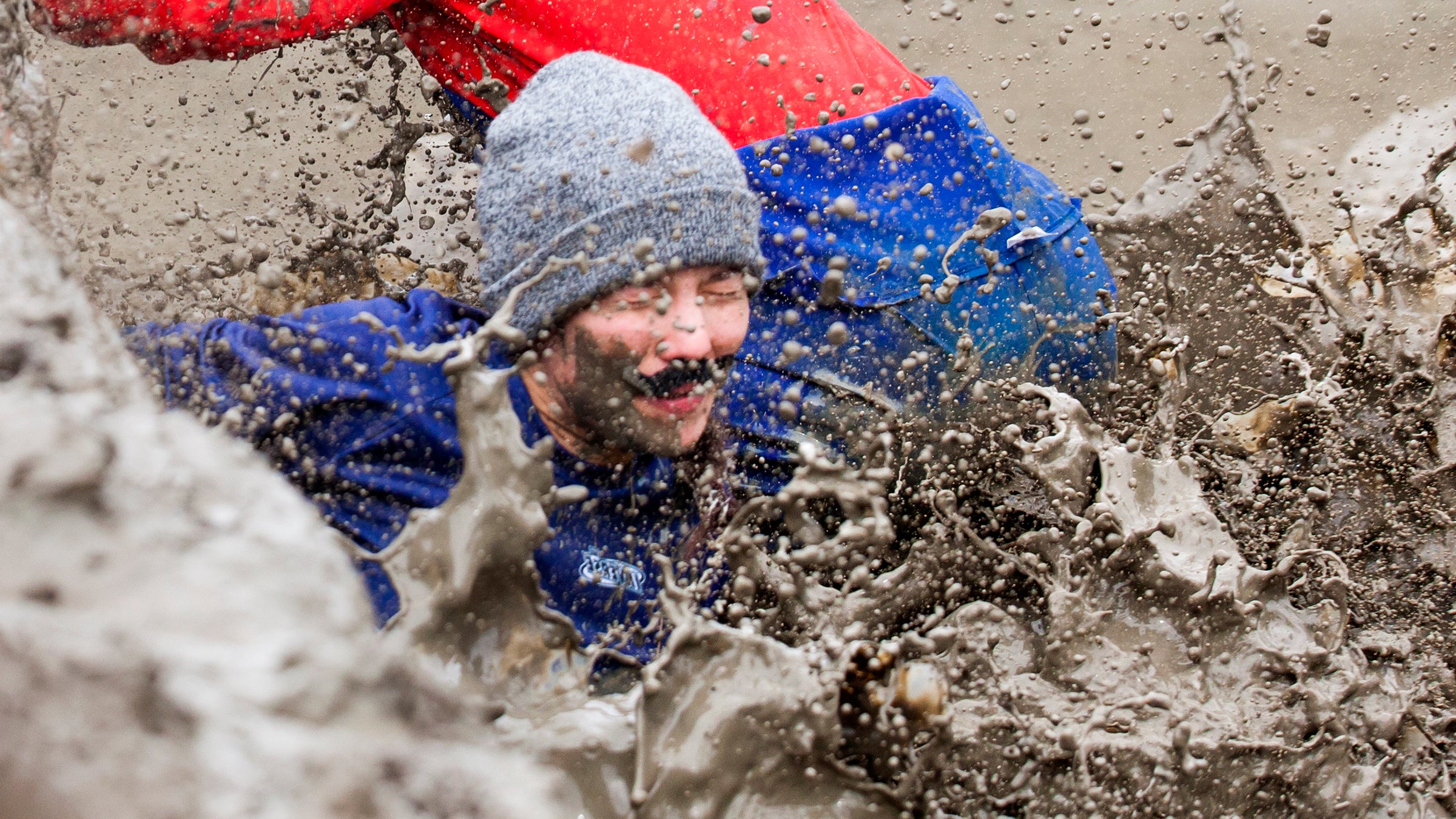 Necrotizing fasciitis, a flesh-eating bacteria, rendered a mud run participant blind in one eye.