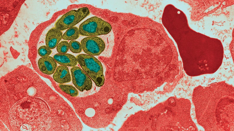 Malaria parasites attacking blood cells.