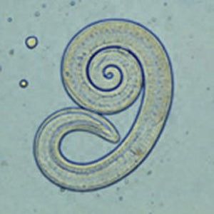 Trichinella spiralis.