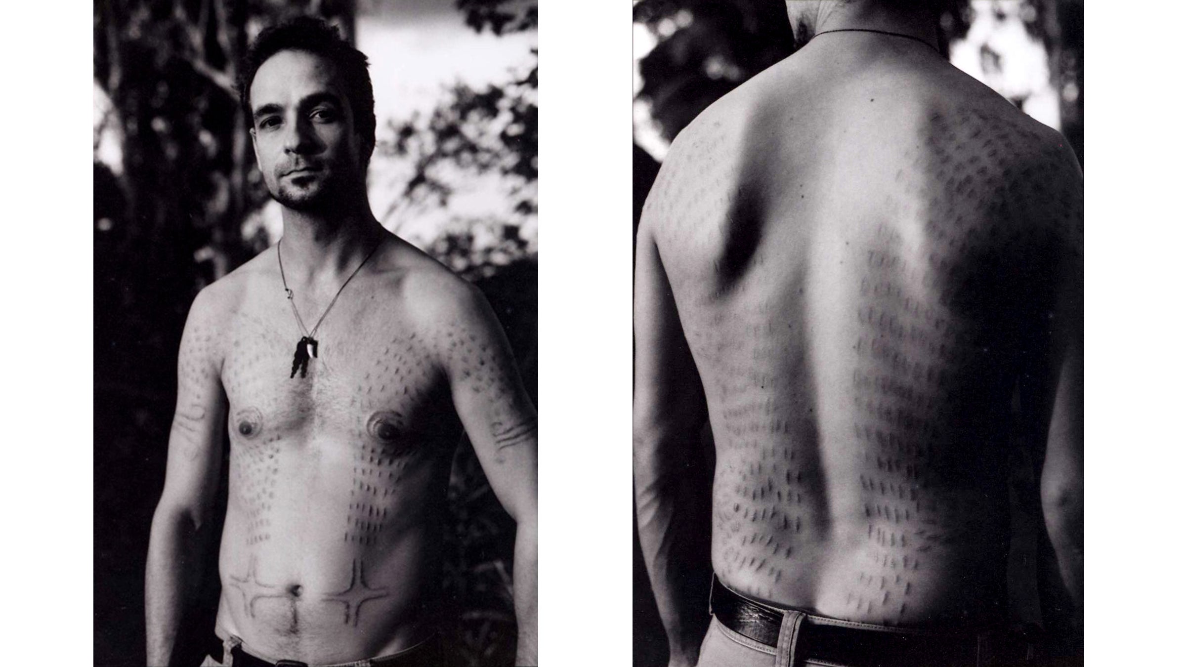 Others who experienced the crocodile cutting ceremony have died from shock or infection.