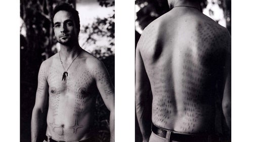 Others who experienced the crocodile cutting ceremony have died from shock or infection.