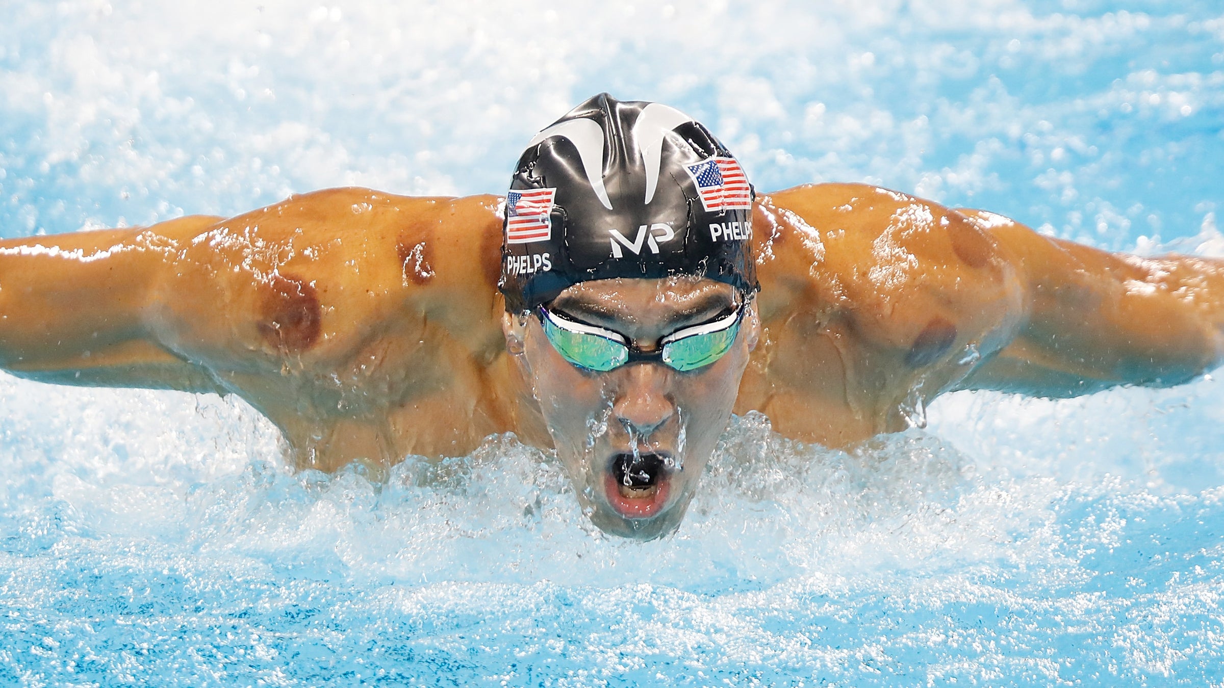 Cupping aside, in the 2016 Olympics alone, a number of high-profile athletes are using alternative techniques to stay healthy through the demands of the Games.