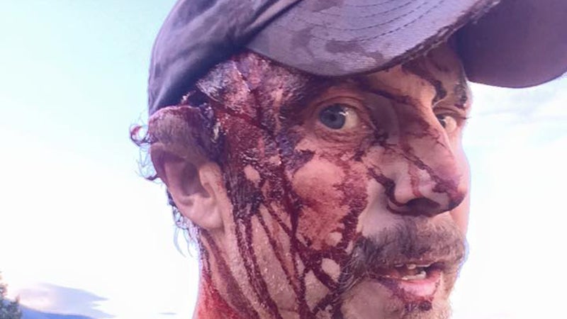 Orr, just minutes after the second attack. 