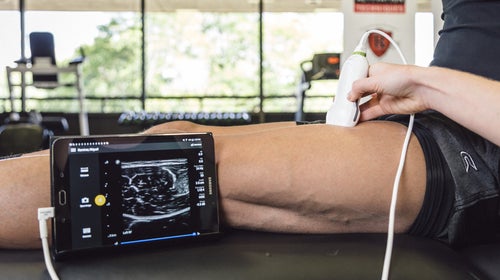 Hardware and process of MuscleSound imaging.