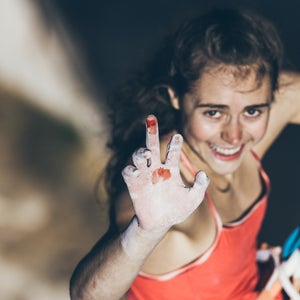 Hayes shows of a battle wound while on La Rambla.