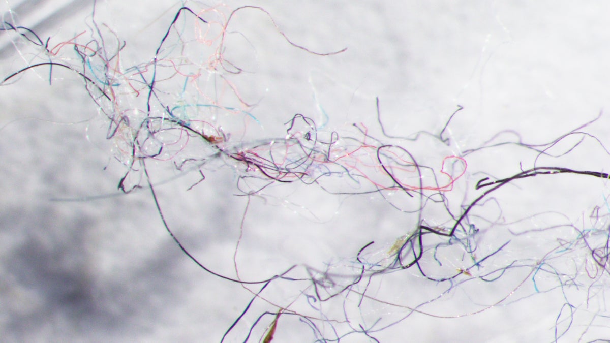 Your Fleece Jacket Pollutes the Ocean. Here’s the Possible Fix.