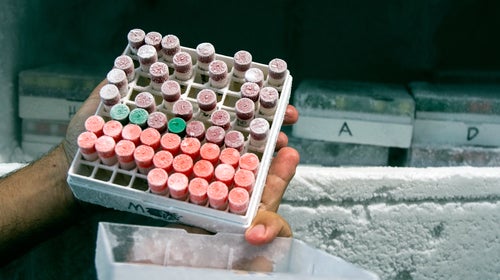 Some yeast samples in the Mellos' freezer.