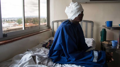 Lesingiran, a teenage Samburu pastoralist shot in the head by KDF bullets.