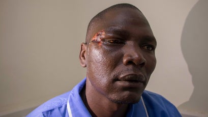 John Mulijo Epar, a Sosian security officer, played dead in his own blood to escape death.