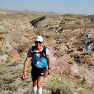 Without hats, you run the risk of overheating in the summertime, getting too chilly in the wintertime, or sunburn at any time of year.