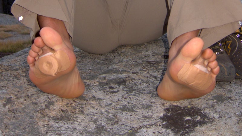 Guy developed bad forefoot blisters on day one. We should have stopped to address them earlier but instead waited until camp.