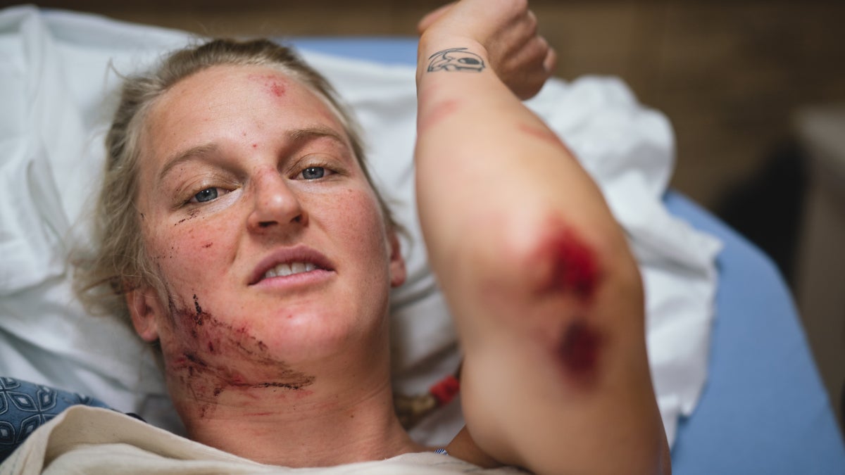 Inside Emily Harrington’s Scary Fall on El Capitan