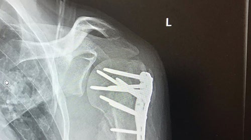 Andrew Bernstein’s repaired humorous