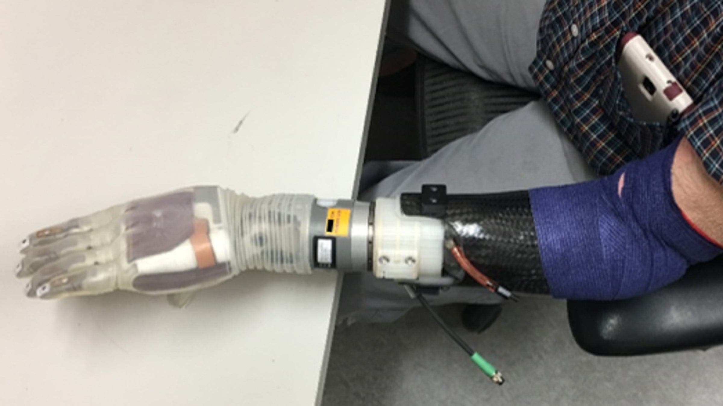 Prosthetic arm on a table