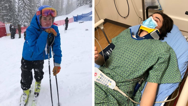 Left: Hatcher at a junior ski racing competition in Colorado. In the emergency room after his fall.