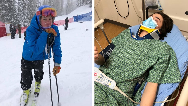 What to Do If You Hit Your Head While Skiing?