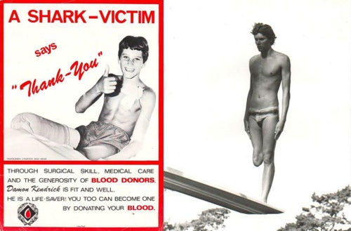 From left: Damon Kendrick, about 36 hours after his attack; Kendrick competing in springboard diving