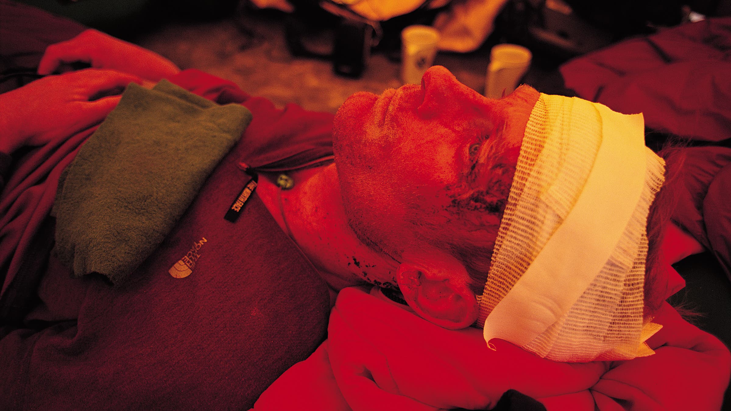 Anker recuperating in a tent shortly after clawing his way out of the Shishapangma avalanche