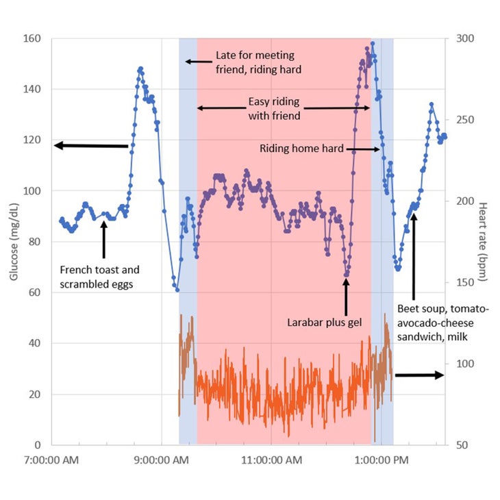 Continuous Glucose Monitoring for Athletes: Benefits of a CGM for