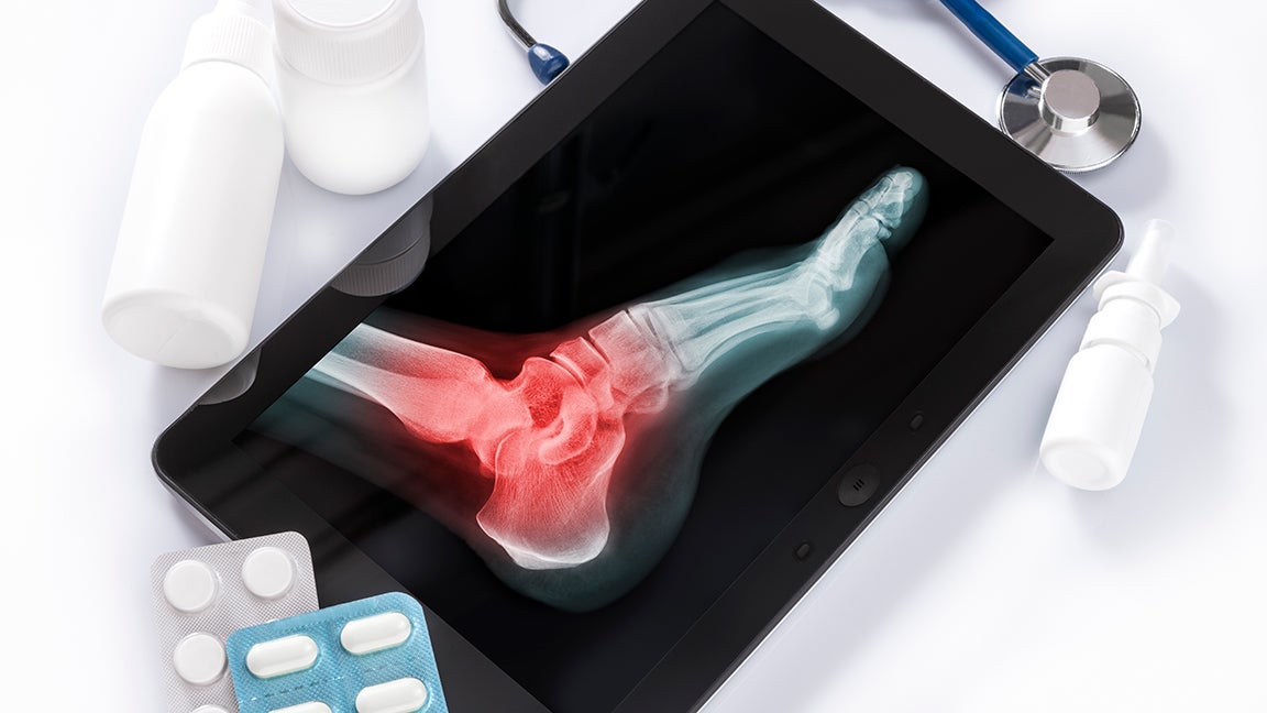 Ankle xray