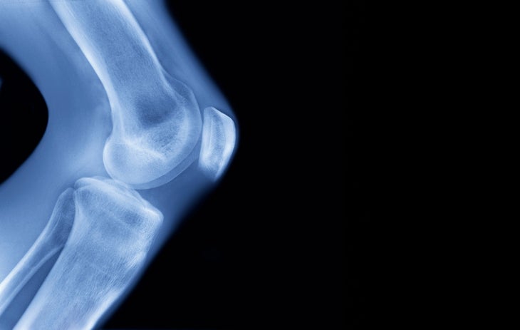 knee cartilage strengthening