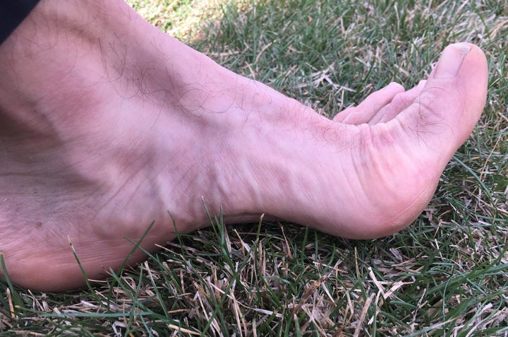 Does Your Foot Shape Determine Your Running Destiny?