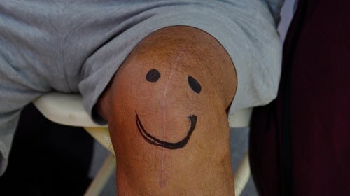 running with a replacement knee