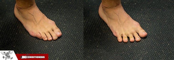 toe splay