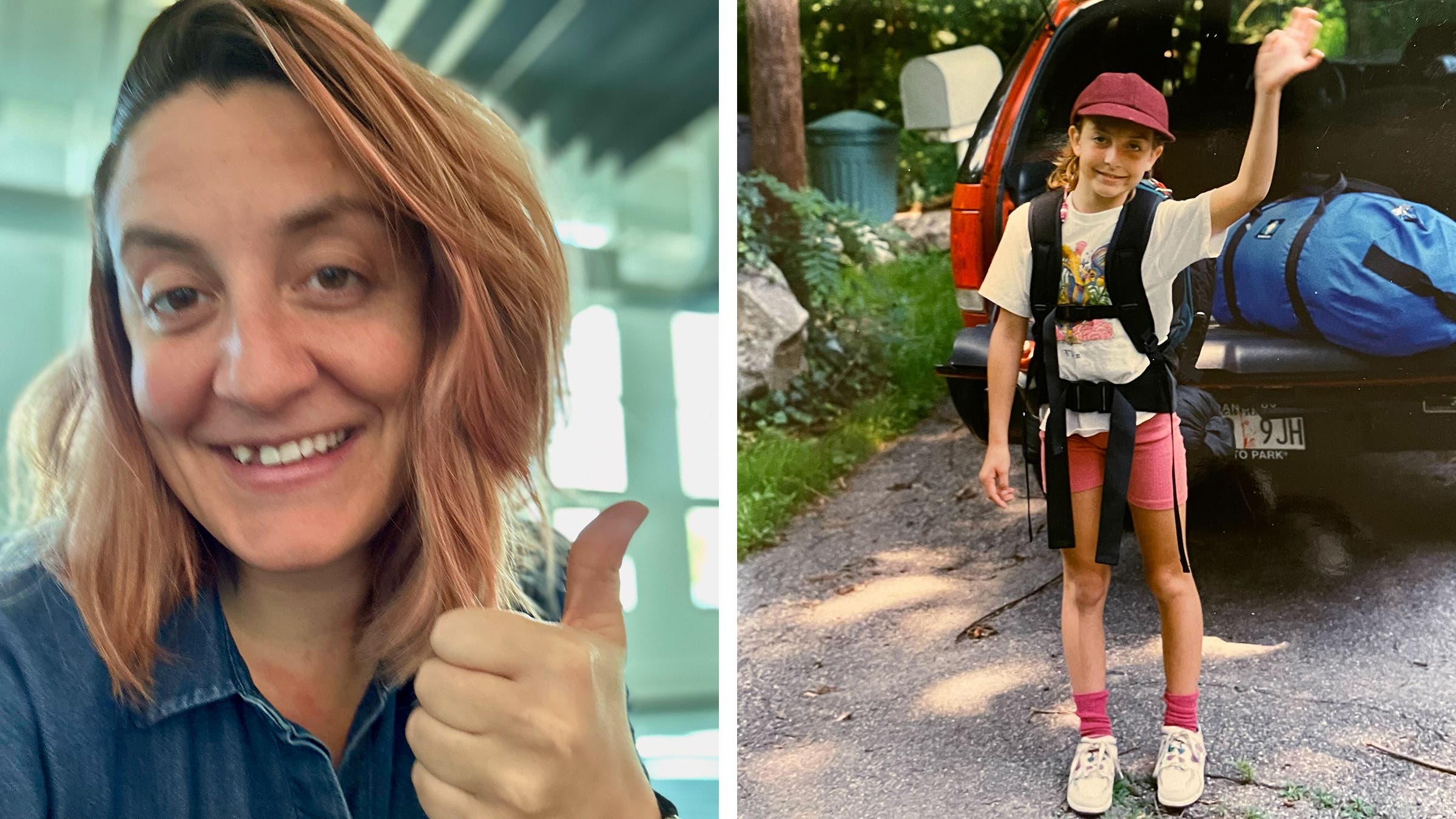 The author, toothless (left) and with a full smile