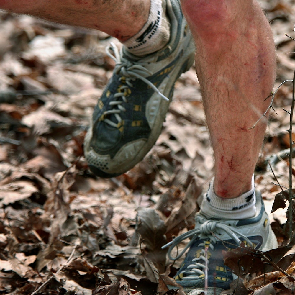 legs cut up running at the Barkley Marathons
