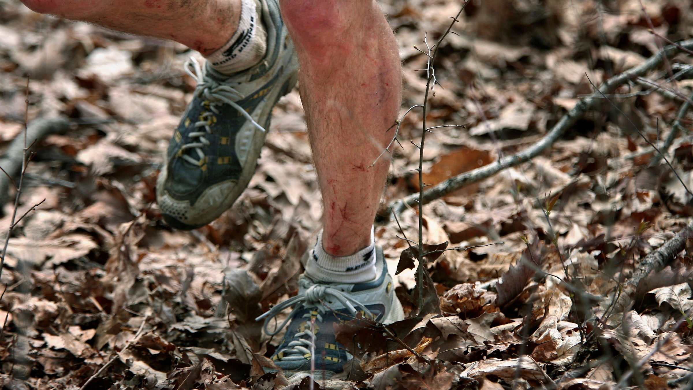 legs cut up running at the Barkley Marathons