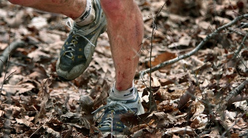 legs cut up running at the Barkley Marathons