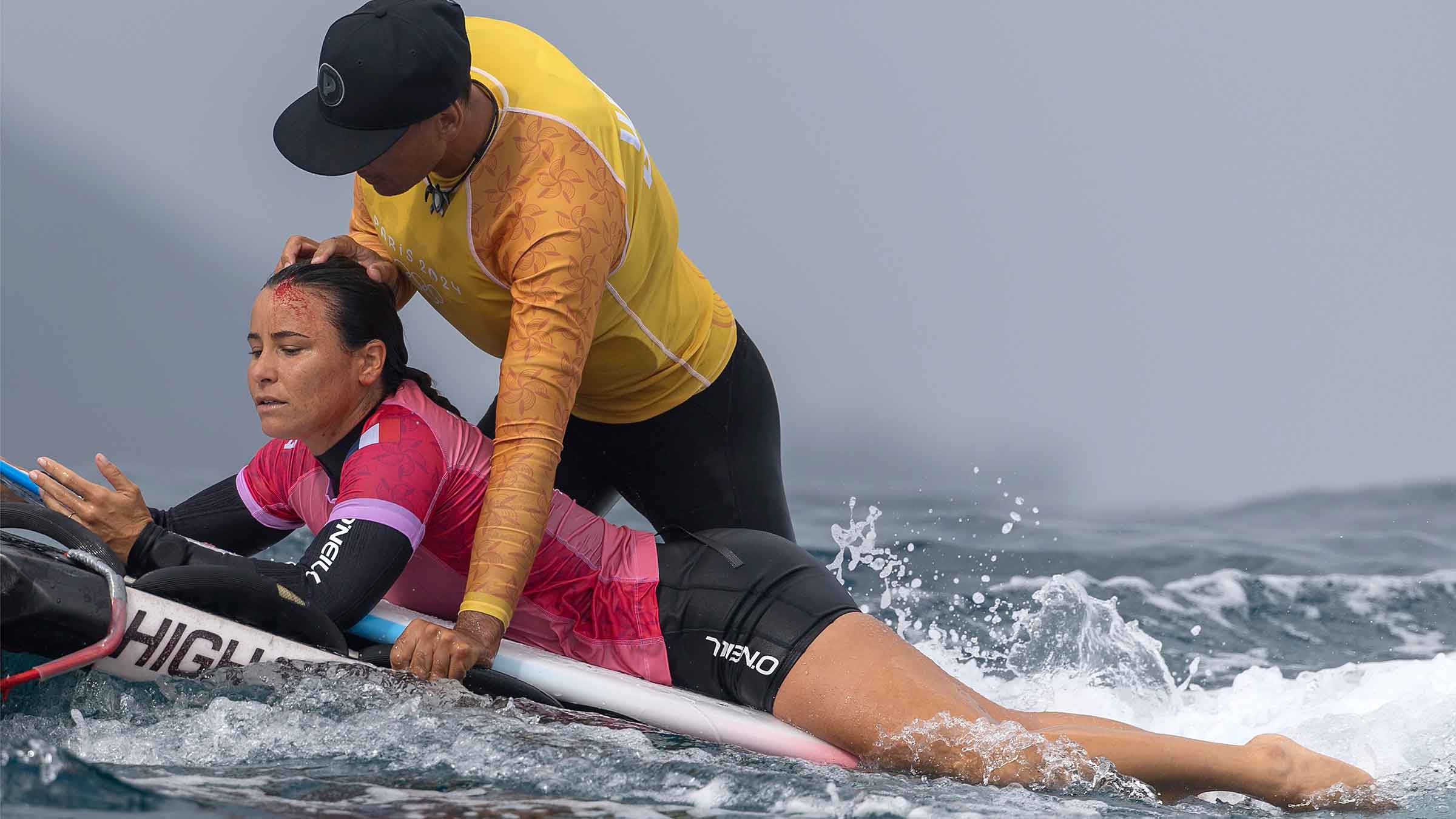 Johanne Defay gets examined by medical staff after being injured during round one of surfing at the 2024 Olympic Games on July 27, 2024 in Teahupo'o, French Polynesia.