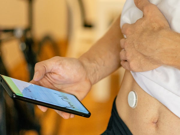 Male athlete, cyclist or triathlete, in cycling clothes is measuring lactate level with a continuous lactate monitor