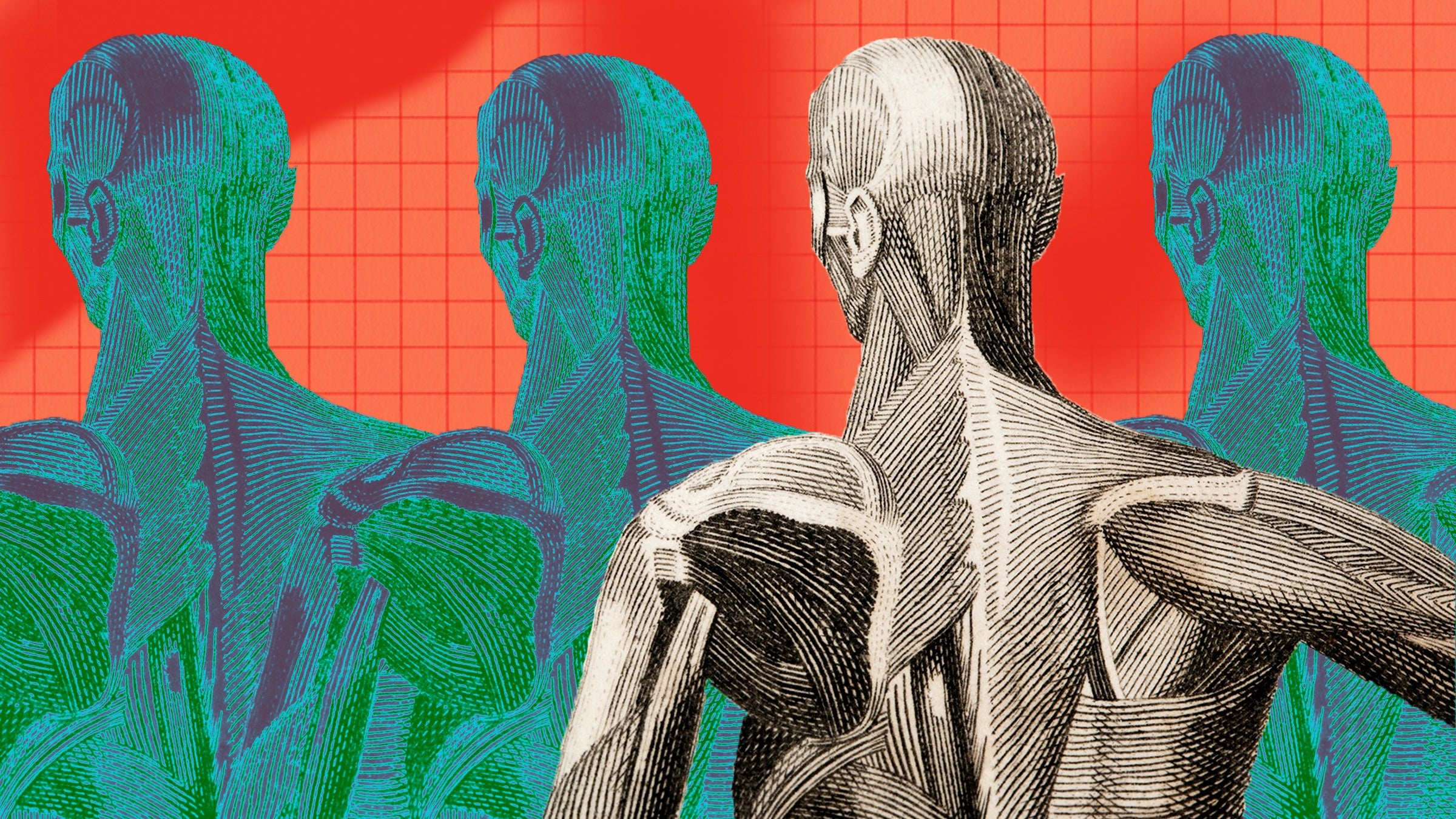 Anatomical illustration of a man's back displaying the muscular structure