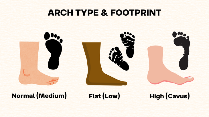 arch types and footprints