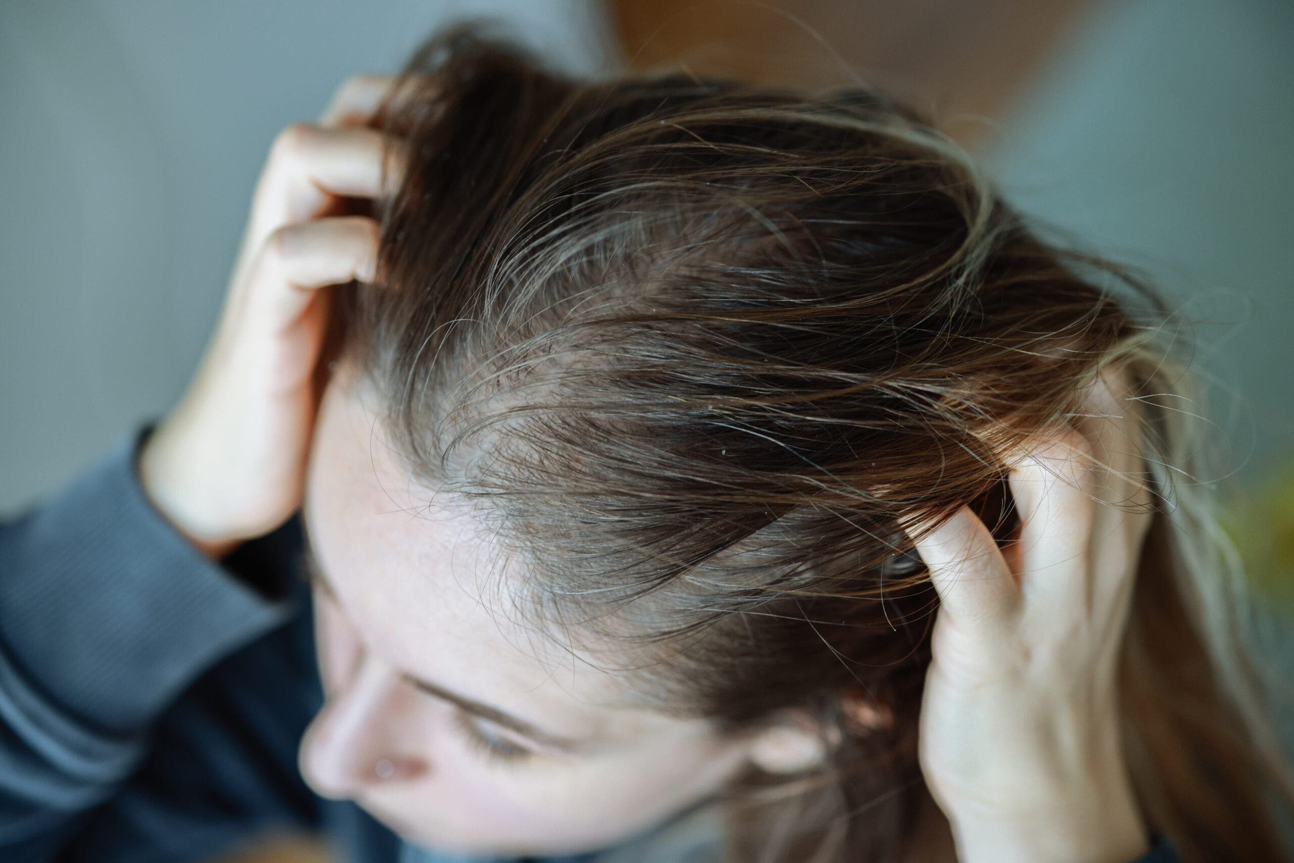 Woman studying her scalp