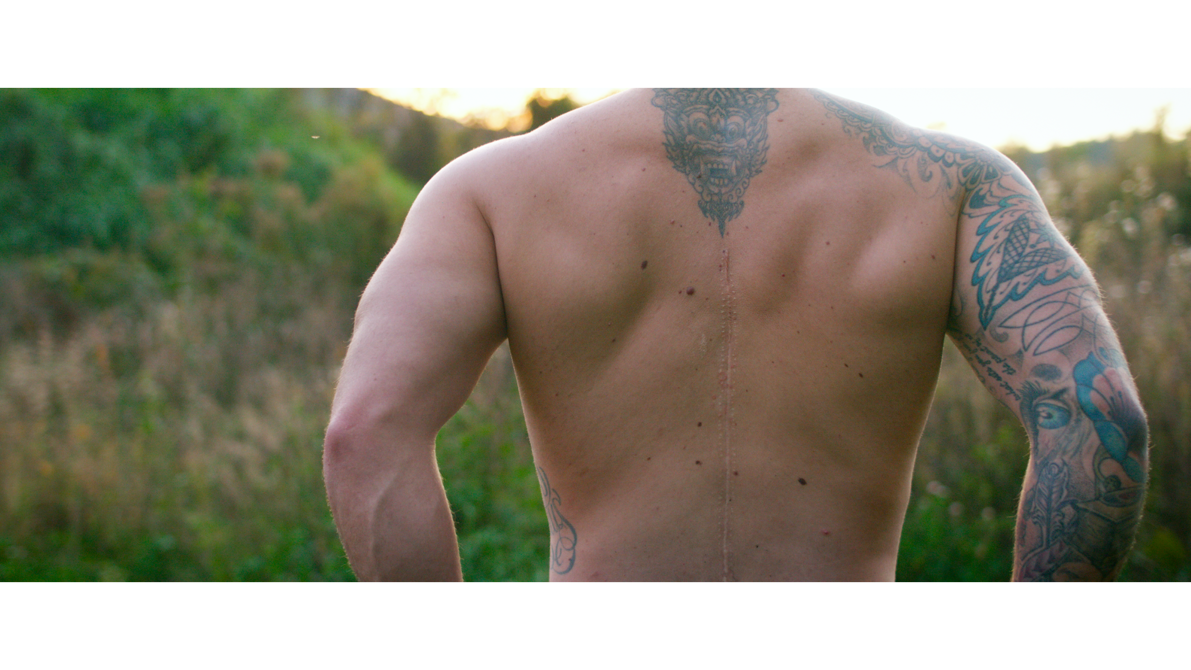 adaptive rider showing their spinal cord surgery scar