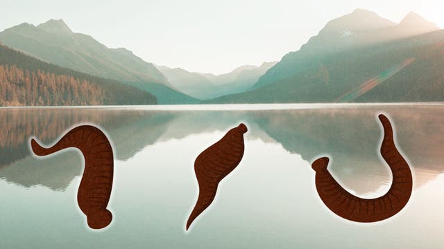 Could Leech Facials Help Cure My Phobia of Them?