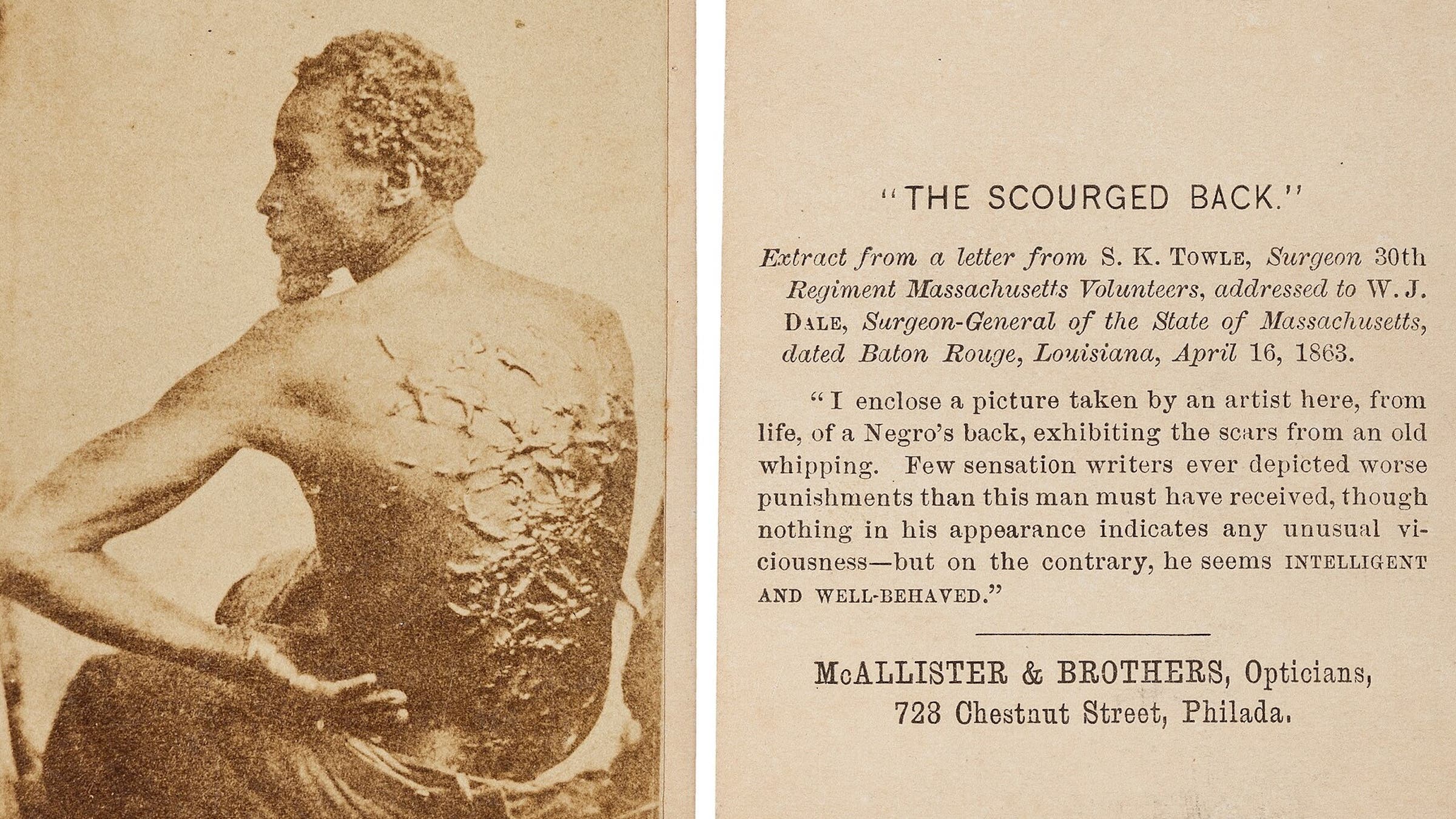 Peter Gordon, a formerly enslaved person, took photos of himself to document his scars from whipping