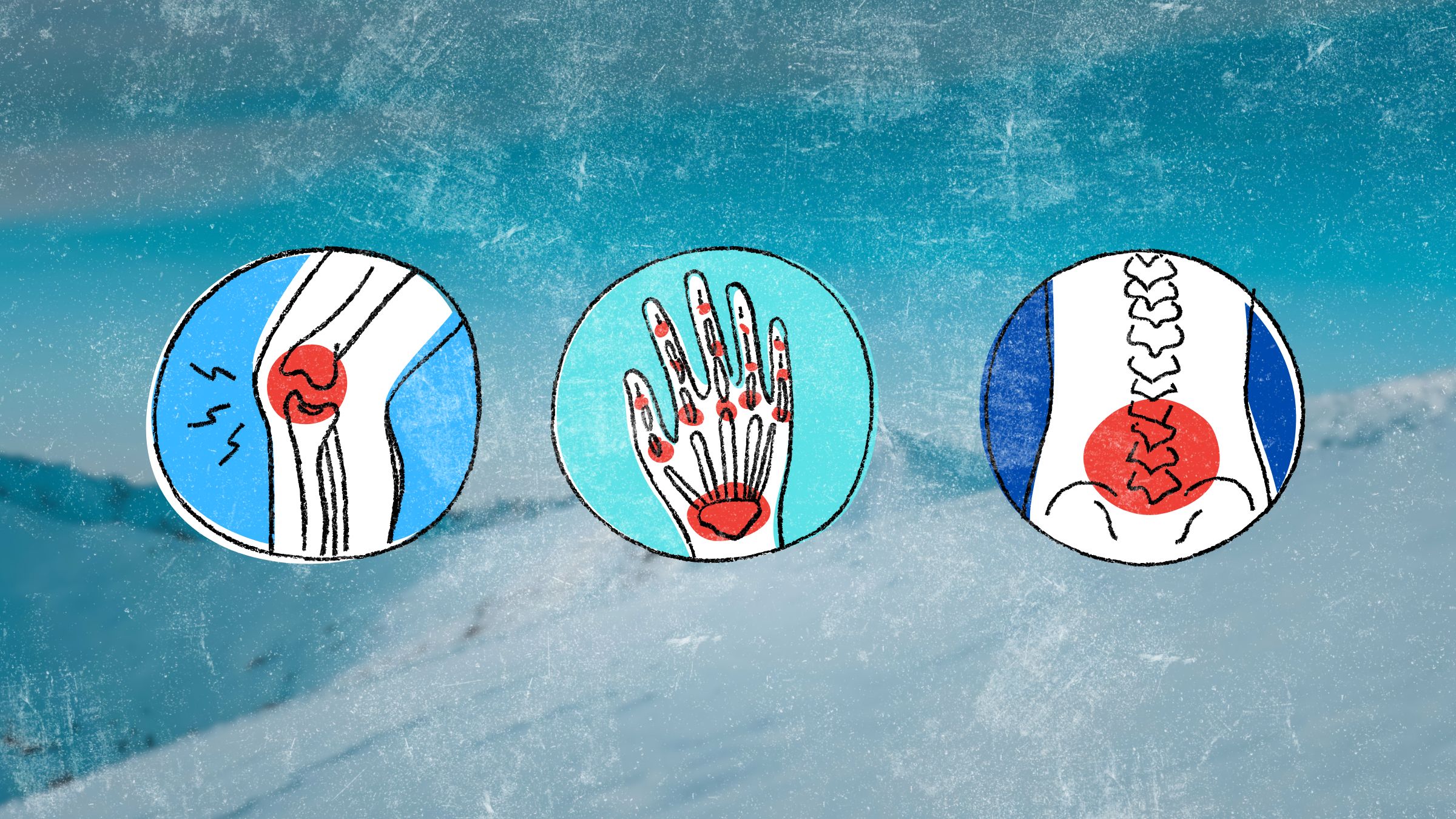 sore muscles and joints in cold weather