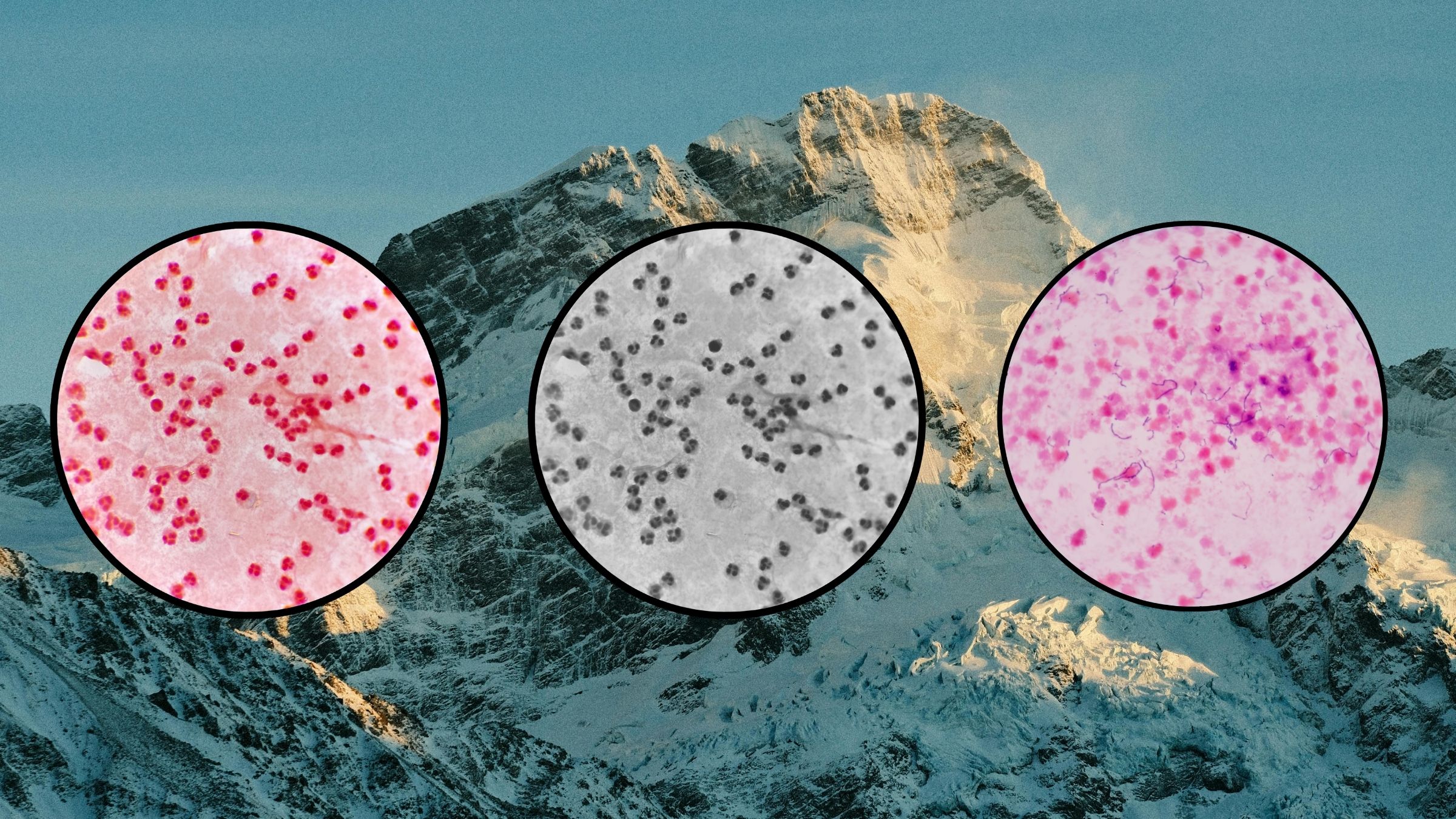 Can Probiotics Help Climbers Better Adjust to High Altitude?
