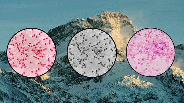 Want to Feel Better at Altitude? Look at Your Gut Health.