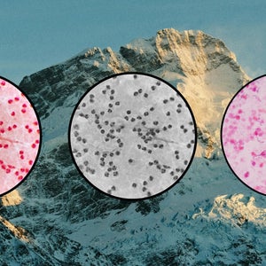 a picture of bacteria petri dishes on a mountain background to depict gut health at altitude