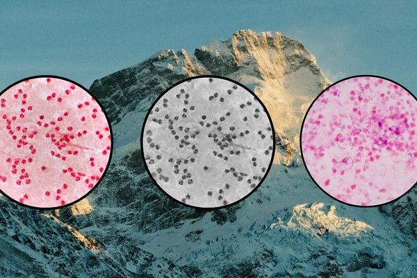 a picture of bacteria petri dishes on a mountain background to depict gut health at altitude