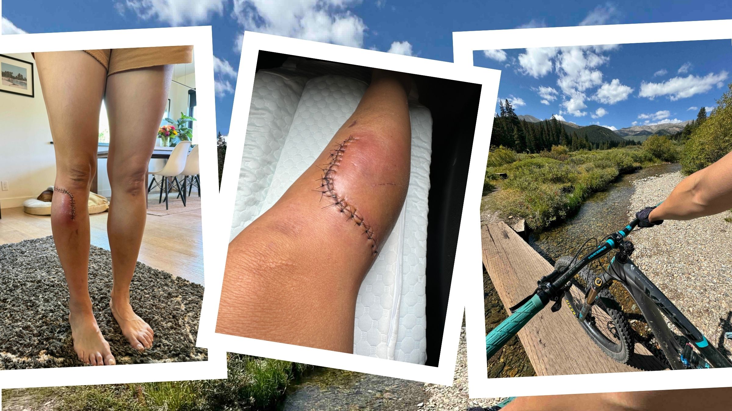 My iPhone’s SOS Feature Saved Me After a Bike Crash