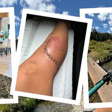 collage of bike injury and arterial gash