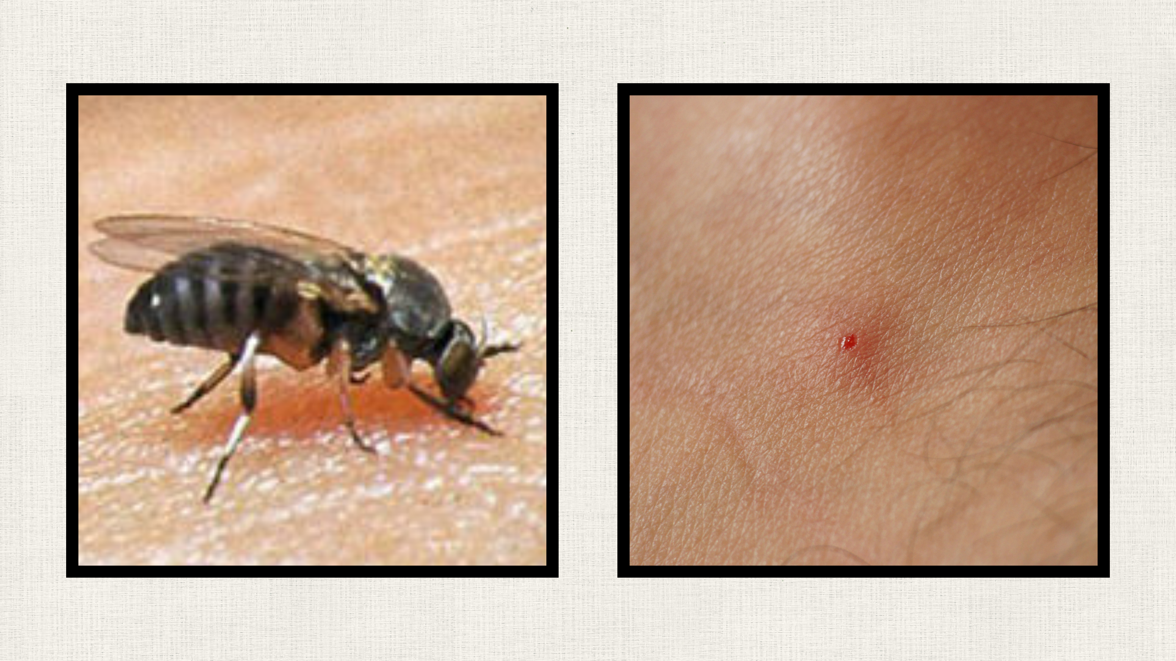 black fly and black fly bite