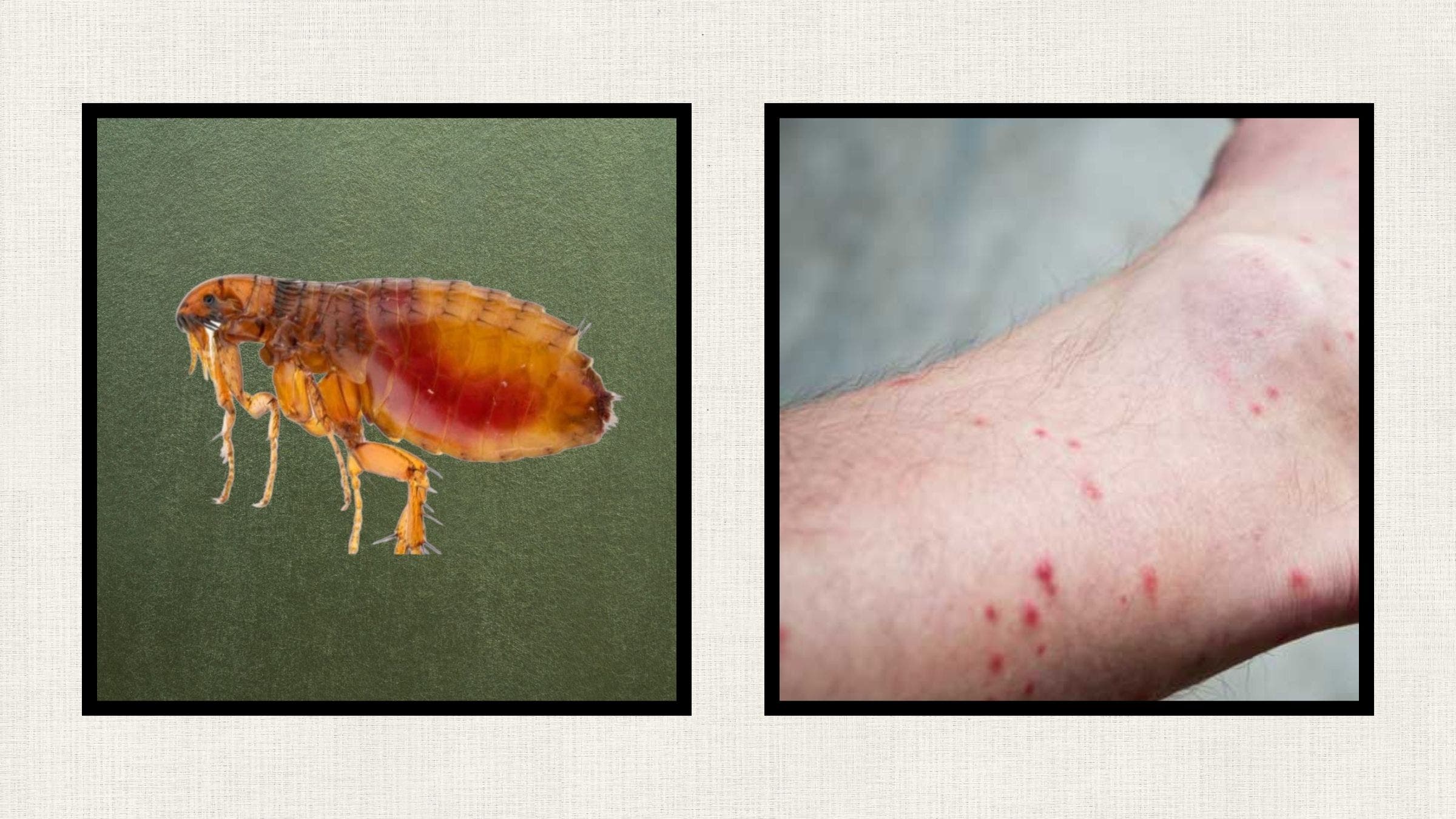 fleas and flea bite